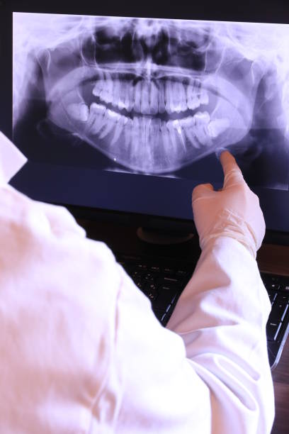 Best Emergency Broken Tooth Repair in Coventry Lake, CT
