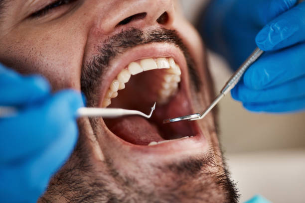Best After-Hours Emergency Dentist in Coventry Lake, CT