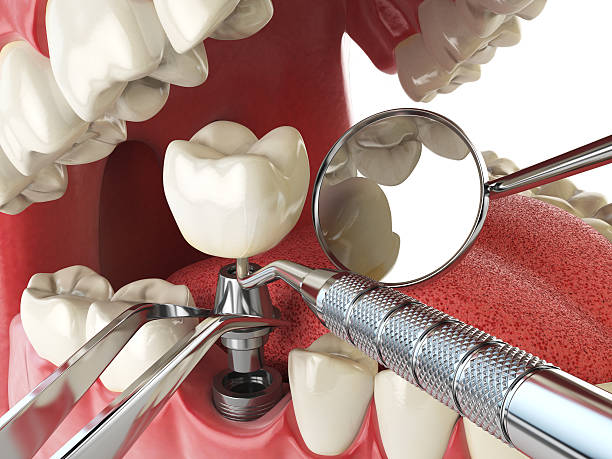 Best Emergency Dental Surgery in Coventry Lake, CT